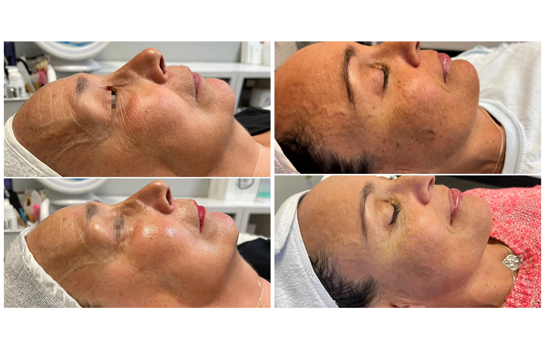 four panel before and after