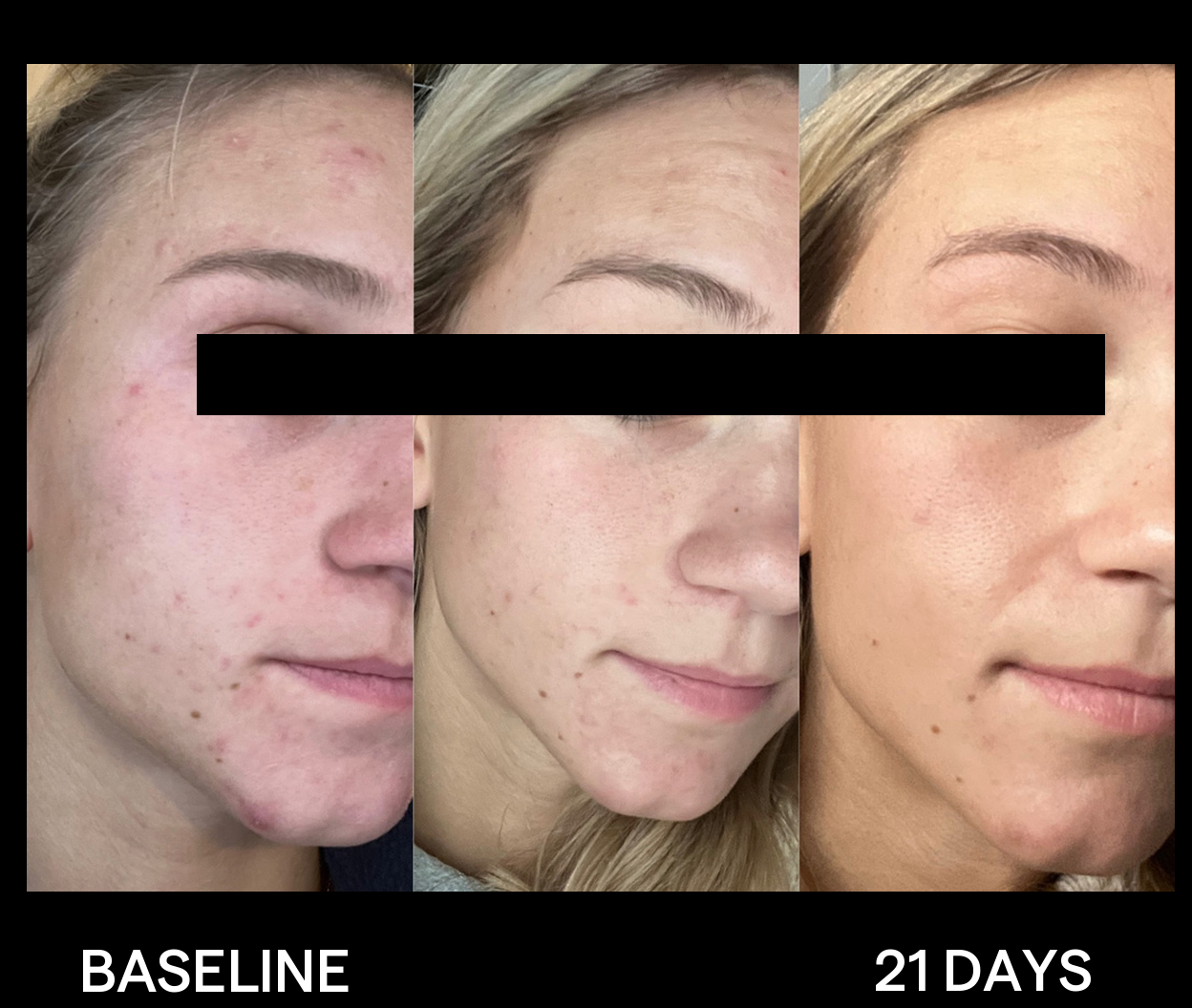 SIV Biome Balancing Serum