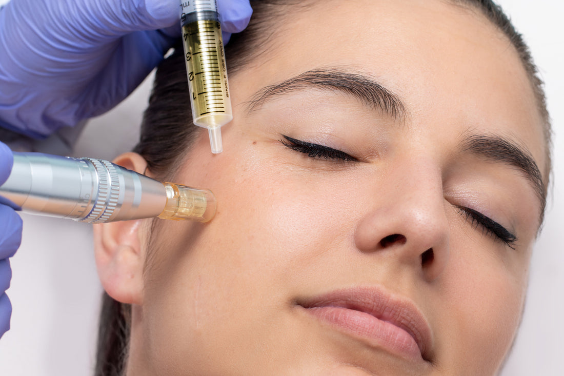 Exosome Microneedling